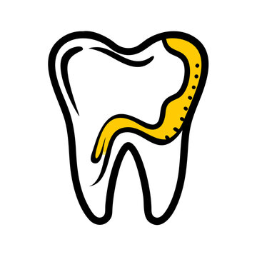 Tooth with root canal treatment, dental health procedure illustration.
