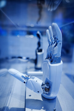 Advanced Robotic Prosthetic Hand with Mechanical Joints