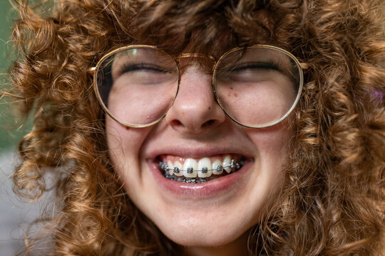 A teenage girl with glasses and braces shows a happy smile