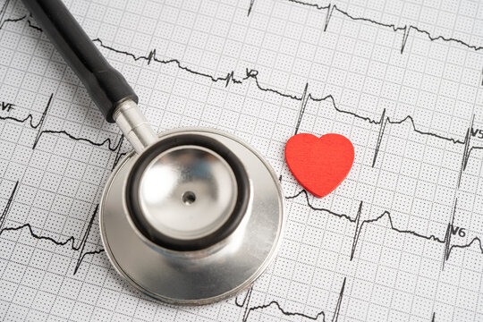 Stethoscope on electrocardiogram ECG, heart wave, heart attack, cardiogram report.