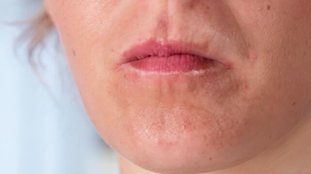 Person Placing Nicotine Pouch Inside Mouth