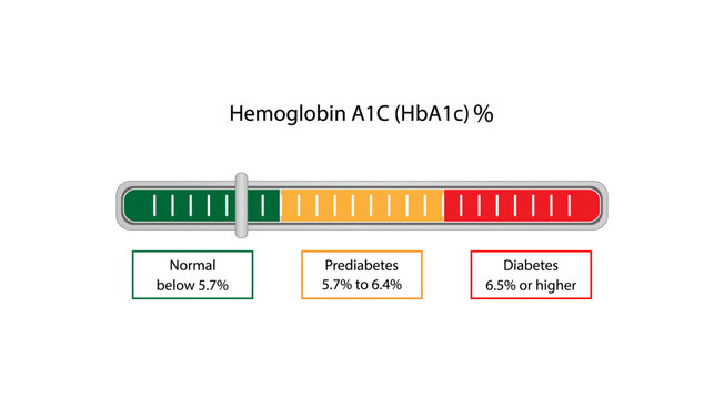 Hemoglobin A1C, HbA1c test results, glycated hemoglobin, A1C Blood Sugar Test, Diabetes Mellitus. Vector illustration.