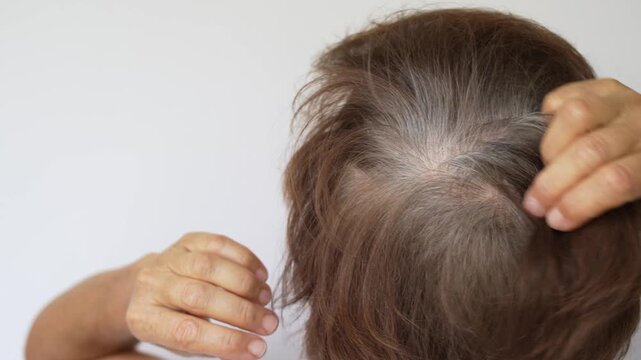 Close-up of the top of a woman&rsquo;s head showing gray roots, thinning hair and natural graying at the crown on a light background