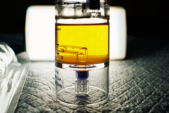 PRP plasma