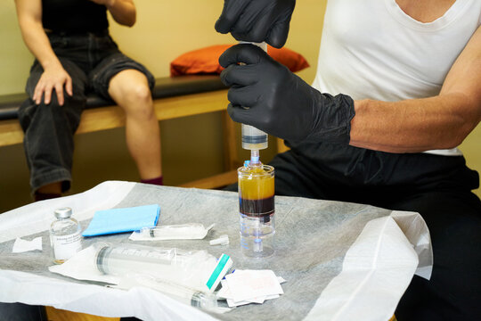 PRP Preparation for Torn Meniscus