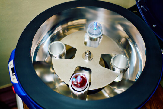 Medical centrifuge machine for PRP procedure