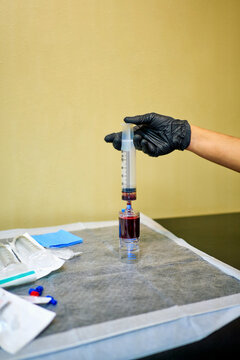 Platelet-Rich Plasma PRP process