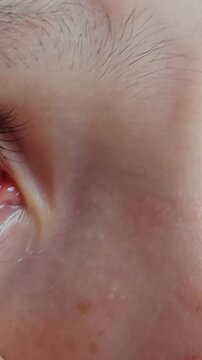 Removing a foreign object from a child's eye in a medical setting