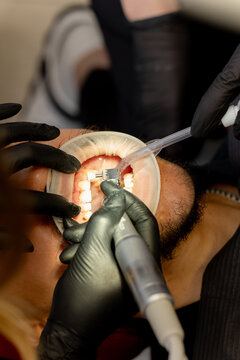 Dentist polishing patient teeth with rotary tool and saliva ejector