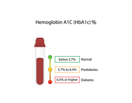 Hemoglobin A1C, HbA1c test , HbA1c levels, Glucose sticks to hemoglobin, glycated hemoglobin, up to 120 days. A1C Blood Sugar Test, Diabetes Mellitus, Infographic, Vector illustration. 