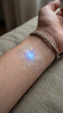 Innovative Glucose Monitor Patch on Arm Displayed as a Biohacking Trend for Diabetes Management Image made using Generative AI.