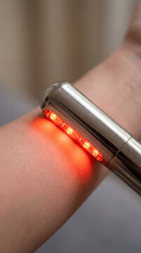 Red light therapy sport device emitting infrared light, applied to an arm for potential skin treatment and healing. Close-up highlights details and effectiveness. Image made using Generative AI.