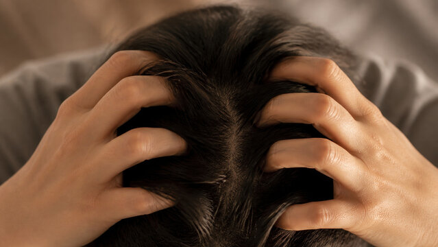 Hands scratching head with hair scalp close up