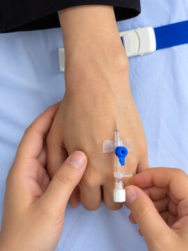 Peripheral IV catheter insertion into patient hand, close-up of intravenous cannulation procedure in medical setting
