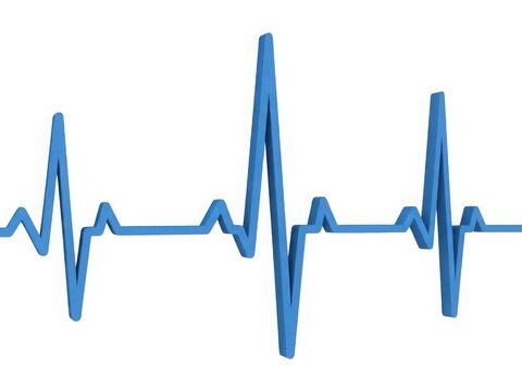 Heartbeat graph