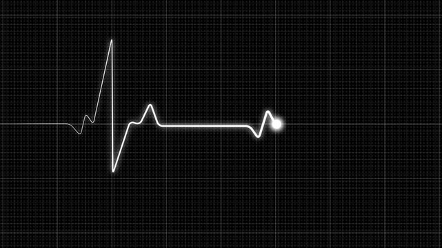 White EKG heartbeat animation pulses across a dark medical tech grid. Vital patient pulse rates monitor on this EKG heartbeat. Hospital cardiogram telemetry guides the EKG heartbeat.