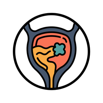 Bladder Tumor Cystography Scan Icon for Urology
