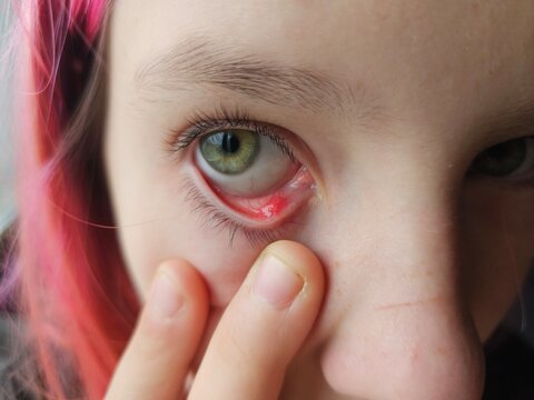 Close-up of a girl showing her eye and fingers