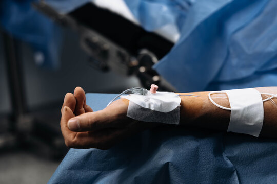 Close-up of a patient's forearm with adhesive electrodes and vascular access prepared for a surgical procedure. Sterile blue drapes, clinical setting, patient monitoring and perioperative care.