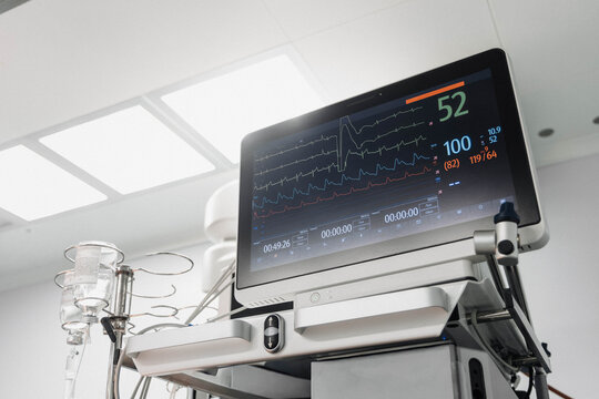 Medical monitor displaying vital signs in a modern operating room. Anesthesia workstation and monitoring equipment prepared for perioperative patient care during surgery.