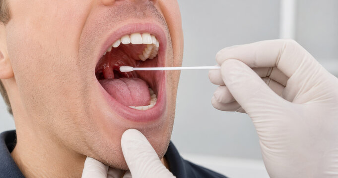 Doctor taking throat swab test from man with open mouth. Sore throat and tonsillitis examination. Angina diagnosis and medical checkup concept for healthcare and clinic