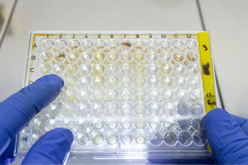Agglutination reaction of red blood cells to substances secreted by bacteria, which is carried out...