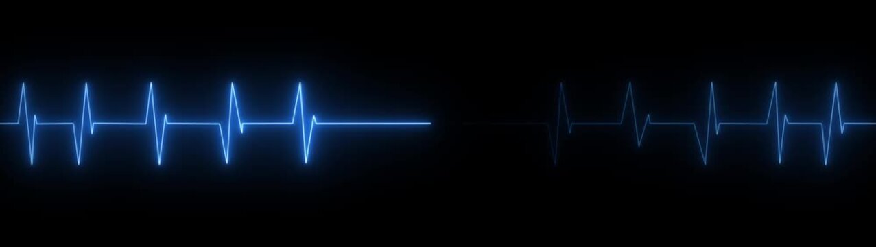 A vibrant neon blue electrocardiogram line pulses across a stark black background representing a healthy heartbeat or medical data visualization Keywords: electrocardiogram, ecg, heart, beat