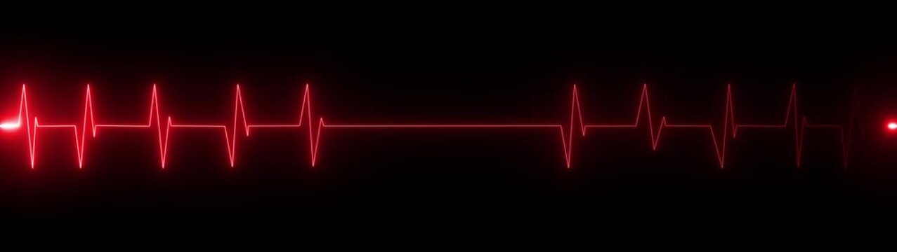 A vivid neon red electrocardiogram line with a prominent bright spike indicating an anomaly or critical medical event against a dark backdrop Keywords: electrocardiogram, ecg, heart, beat, pulse