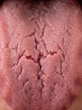 Extreme macro view of a fissured human tongue showing deep grooves and papillae for medical education, dermatological studies, and healthcare presentations.