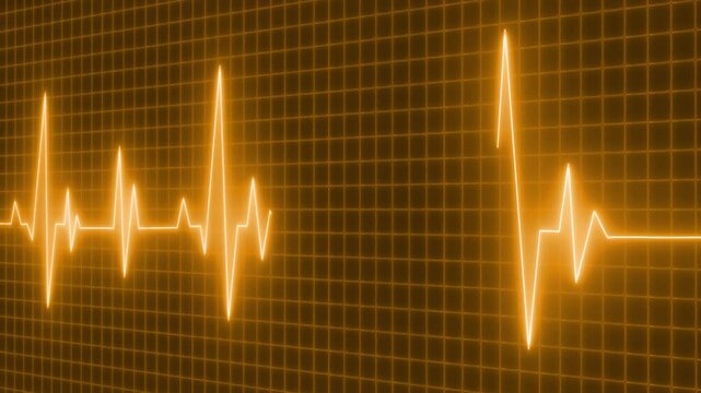 Glowing ecg heartbeat waveform on grid background animation, Electrocardiogram waveform glowing heartbeat pulse lines across screen