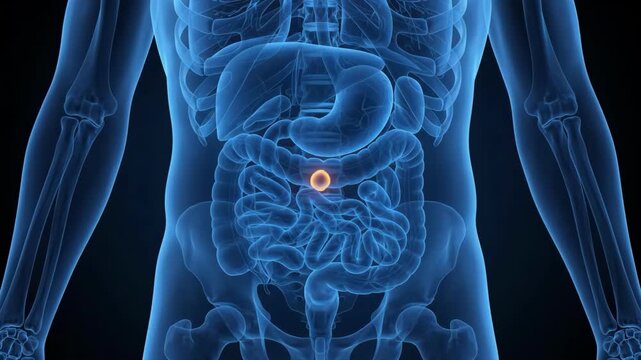 3D rendering of human digestive system with highlighted area indicating a tumor or inflammation in the intestines, representing medical diagnosis and research.