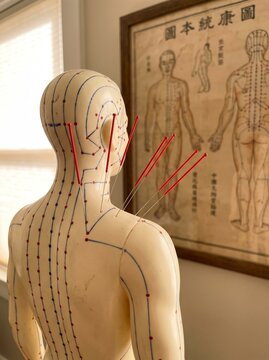 Acupuncture mannequin showing body meridians and needles with acupuncture model