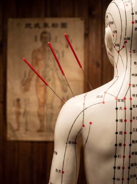 Acupuncture anatomical model with needles on a shoulder, meridian chart