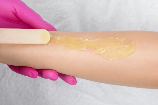 Sugaring hair removal procedure with wax on woman arm sugaring epilation cosmetic skincare professional