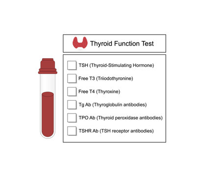 Thyroid function test, Thyroid gland. Blood sample in test tube. TSH, T3 and T4 hormones. Thyroglobulin, Thyroid peroxidase and TSH receptor antibodies. Hypothyroidism and hyperthyroidism.  