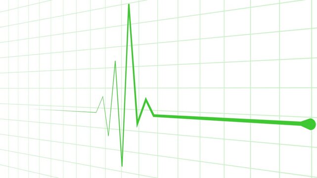 Minimal heartbeat line and sharp pulse spike wave animation
