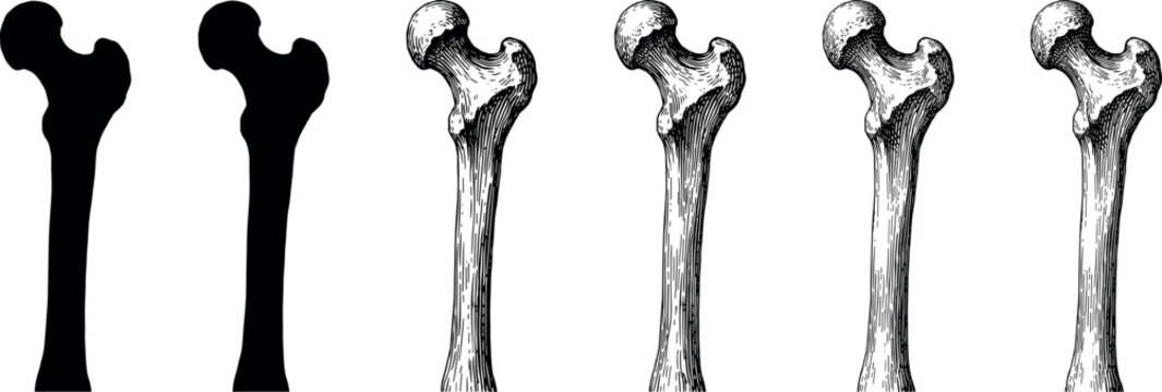 Femur bones illustration showcases varying styles and detailed anatomy