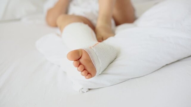 Children's broken leg in orthopedic cast on a white bed in the . Broken leg in cast of an young child