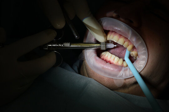 Dentist hands in gloves hold syringe injecting anesthesia into patient gums. Retractor holds mouth open. Blue suction tube present. Dark background highlights procedure
