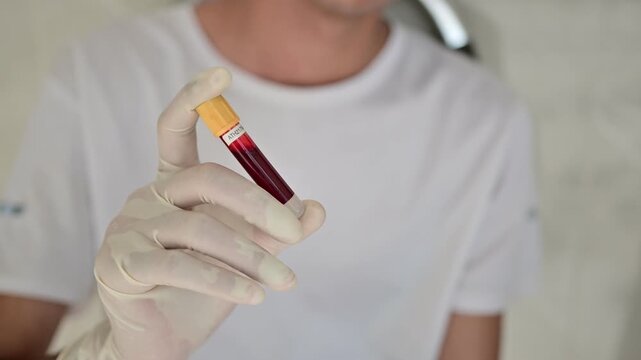 Capillary blood, blood obtained from small capillary vessels containing plasma, red and white blood cells, platelets, hemoglobin, nutrients, gases, and metabolic substances

