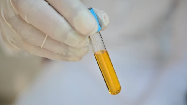 Blood serum, the clear pale yellow liquid obtained after blood clotting, containing water, electrolytes, proteins, antibodies, hormones, nutrients, and dissolved biochemical components

