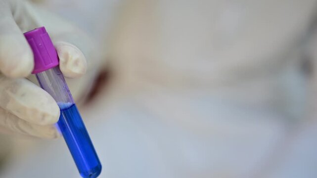 Coomassie blue, a blue protein-binding dye used for electrophoresis, biochemical staining, protein visualization, quantitative assays, microscopy, and laboratory research


