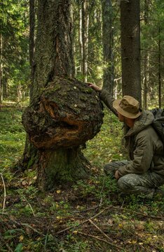 Hiker examining giant burl growth on forest tree trunk. A giant growth on a birch trunk, a birch burl.