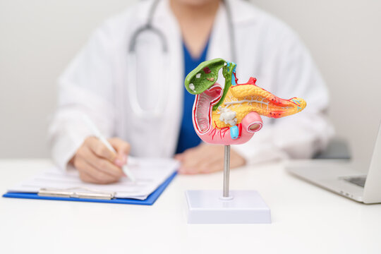 Doctor with human Pancreatitis anatomy model with Pancreas, Gallbladder, Bile Duct, Duodenum, Small intestine. Pancreatic cancer, Acute and Chronic pancreatitis, Digestive system and Health concept