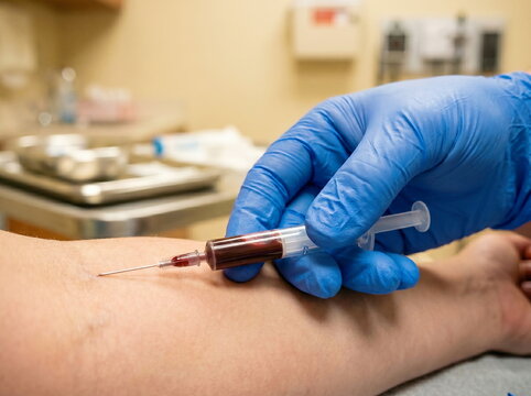Medical professional performing blood draw using syringe from patient's arm in healthcare setting, for diagnostic testing and medical examination.