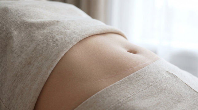 Close Up of Woman Lower Abdomen with Healed Horizontal Caesarean C-Section Scar