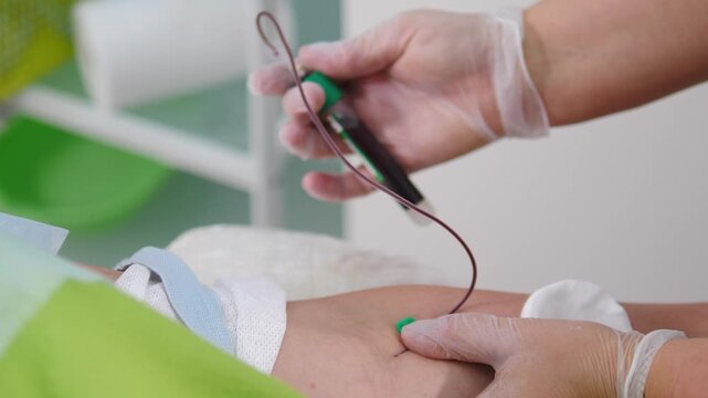 Doctor gloved hand collecting blood sample from patient arm using needle and tube. Medical professional taking blood for testing in modern clinical laboratory setting 4k video