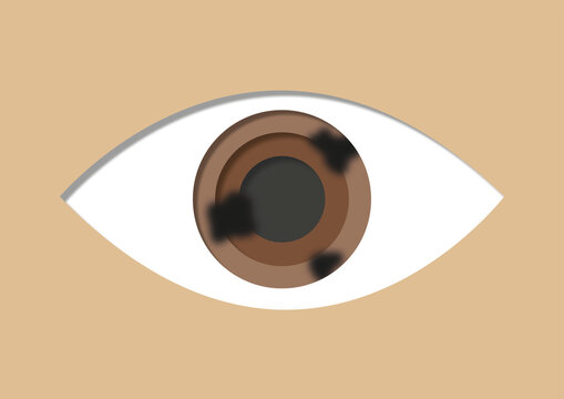 Diabetic retinopathy, conceptual illustration