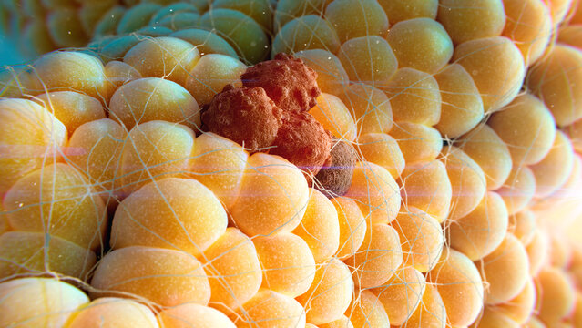 Cancer amongst healthy cells, illustration