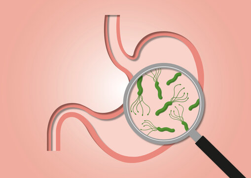 Helicobacter stomach infection, conceptual illustration